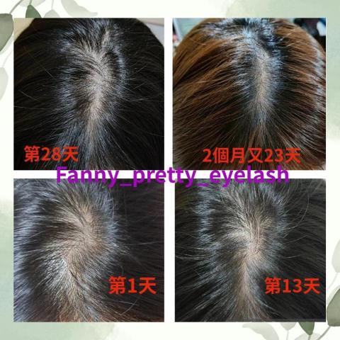 fanny_pretty_eyelash - 科技育髮-頭頂分線