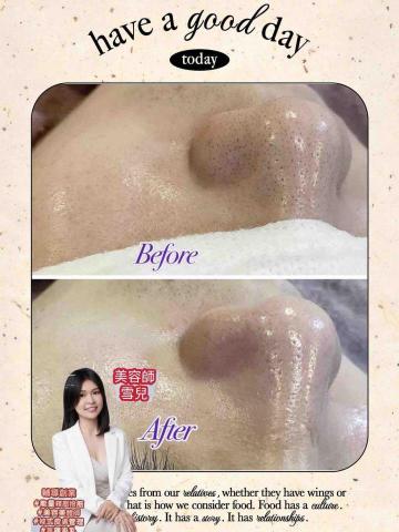 綠之草·蘿琳達·雪兒美學 - .
✨【粉刺OUT,光滑GET】✨
黑頭粉刺讓你的鼻子看起來粗糙暗沉嗎?
雪兒老師幫你「深層清潔+溫和護理」,
讓毛孔乾淨透亮,肌膚回到最初的光滑細緻。
? 一次療程,明顯看得見
✔ 減少黑頭粉刺
✔ 改善毛孔粗大
✔ 提升皮膚亮度
?【Before → After】真實見證,不再修圖遮瑕,
輕鬆擁有素顏自信!
? 預約專線:Line @405fcmpx
? 專業美容師|雪兒
IG: https://www.instagram.com/lorinda_pregnant_woman?igsh=aW9 綠之草·蘿琳達·雪兒美學 - .
✨【粉刺OUT,光滑GET】✨
黑頭粉刺讓你的鼻子看起來粗糙暗沉嗎?
雪兒老師幫你「深層清潔+溫和護理」,
讓毛孔乾淨透亮,肌膚回到最初的光滑細緻。
? 一次療程,明顯看得見
✔ 減少黑頭粉刺
✔ 改善毛孔粗大
✔ 提升皮膚亮度
?【Before → After】真實見證,不再修圖遮瑕,
輕鬆擁有素顏自信!
? 預約專線:Line @405fcmpx
? 專業美容師|雪兒
IG: https://www.instagram.com/lorinda_pregnant_woman?igsh=aW9