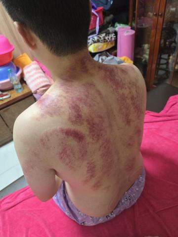 斌師傅整復推拿 - 