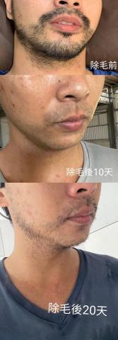 美甲美睫護膚工作室 - 熱蠟除毛效果