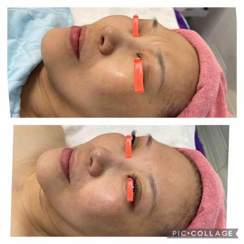 初美Spa美學館 - 