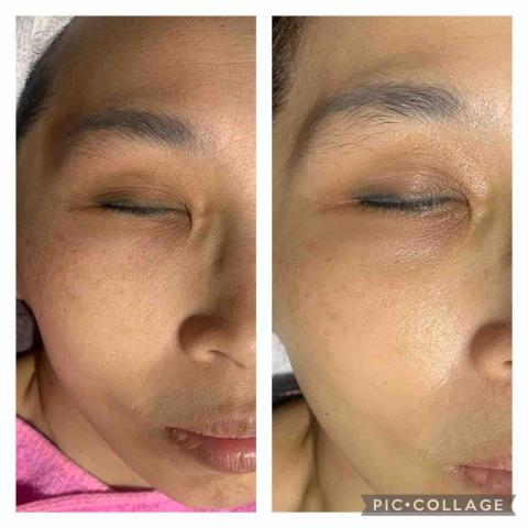 初美Spa美學館 - 