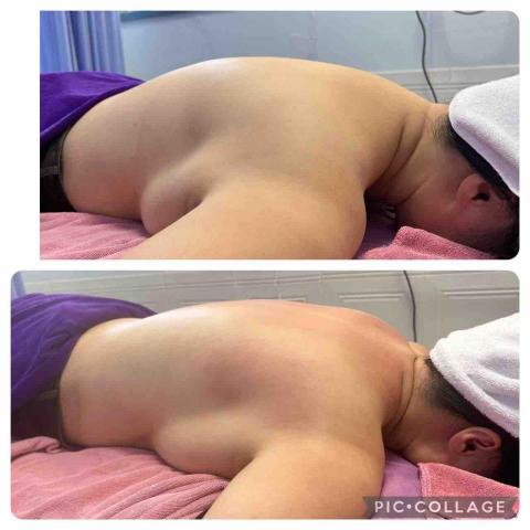 初美Spa美學館 - 背部撥筋