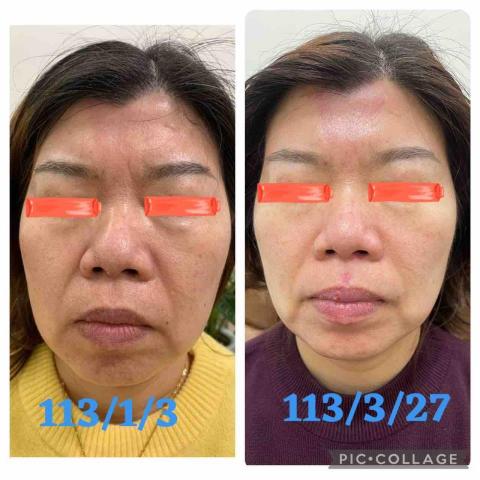 初美Spa美學館 - 