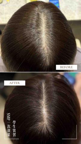 zoYOU左右頭皮美學 - 