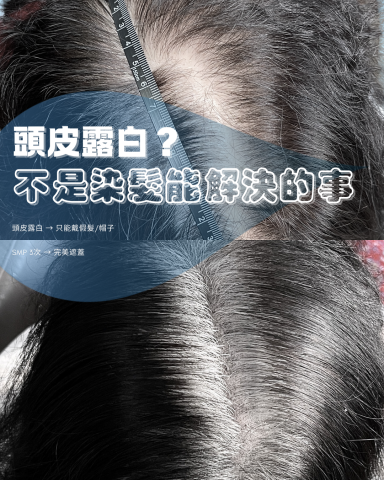 zoYOU左右頭皮美學 - 染髮 · 只能染髮絲
卻無法隱藏頭皮的空白
照片皆為zoYOU左右頭皮美學親手操作，非網路抓路

SMP 頭皮紋髮
三次療程 · 還原自然濃密
效果維持 3～5 年 · 自然淡化成灰
不轉藍 · 不轉紅

我們選用韓國認證專用色素
安全 · 合法 · 為頭皮而生

zoYOU 左右頭皮美學
重視口碑
更重視您的健康與美感

放心來諮詢
給您最適合您的方案