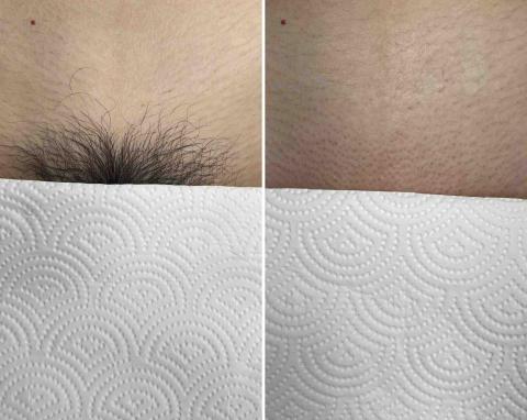 水水除毛美容｜健身❤️ - ♡私密處除毛♡痛感稍微明顯 能減少私密處感染的機會唷！