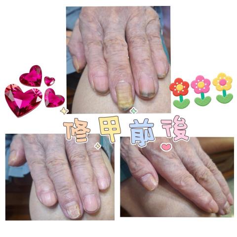 百企到府修剪指甲 - 專業就是學習來照顧案家的
珍惜每一場相遇的瞬間
謝謝你成就了我的全部

☺️無痛☺️舒適照護首選
【店名】：百  企  到  府  修   剪  指  甲
【電話】：0976-658-212 
【LINE聯絡】：https://lin.ee/gaG2G6q
百企到府修剪指甲／問題指甲收放地/成果集
https://www.instagram.com/iopewq21968?igsh=MXB6ZHM