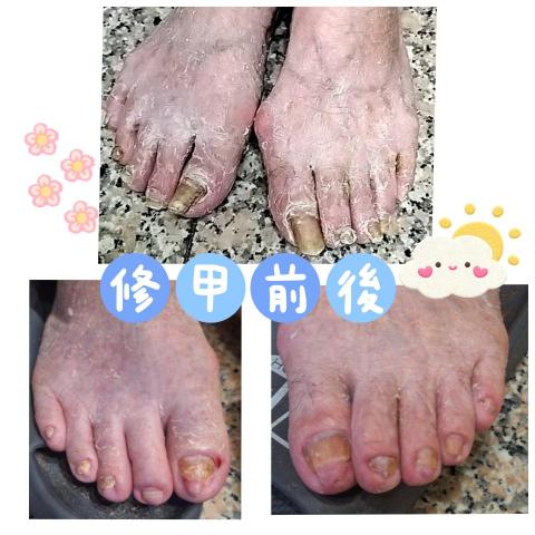 百企到府修剪指甲 - 專業就是學習來照顧案家的
珍惜每一場相遇的瞬間
謝謝你成就了我的全部

☺️無痛☺️舒適照護首選
【店名】：百  企  到  府  修   剪  指  甲
【電話】：0976-658-212 
【LINE聯絡】：https://lin.ee/gaG2G6q
百企到府修剪指甲／問題指甲收放地/成果集
https://www.instagram.com/iopewq21968?igsh=MXB6ZHM