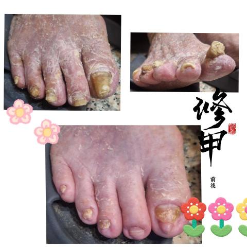 百企到府修剪指甲 - 專業就是學習來照顧案家的
珍惜每一場相遇的瞬間
謝謝你成就了我的全部

☺️無痛☺️舒適照護首選
【店名】：百  企  到  府  修   剪  指  甲
【電話】：0976-658-212 
【LINE聯絡】：https://lin.ee/gaG2G6q
百企到府修剪指甲／問題指甲收放地/成果集
https://www.instagram.com/iopewq21968?igsh=MXB6ZHM