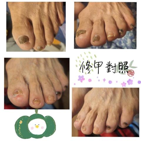 百企到府修剪指甲 - 專業就是學習來照顧案家的
珍惜每一場相遇的瞬間
謝謝你成就了我的全部

☺️無痛☺️舒適照護首選
【店名】：百  企  到  府  修   剪  指  甲
【電話】：0976-658-212 
【LINE聯絡】：https://lin.ee/gaG2G6q
百企到府修剪指甲／問題指甲收放地/成果集
https://www.instagram.com/iopewq21968?igsh=MXB6ZHM