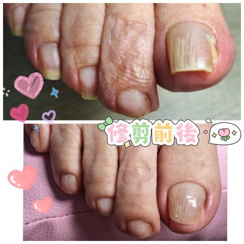 百企到府修剪指甲 - 專業就是學習來照顧案家的
珍惜每一場相遇的瞬間
謝謝你成就了我的全部

☺️無痛☺️舒適照護首選
【店名】：百  企  到  府  修   剪  指  甲
【電話】：0976-658-212 
【LINE聯絡】：https://lin.ee/gaG2G6q
百企到府修剪指甲／問題指甲收放地/成果集
https://www.instagram.com/iopewq21968?igsh=MXB6ZHM