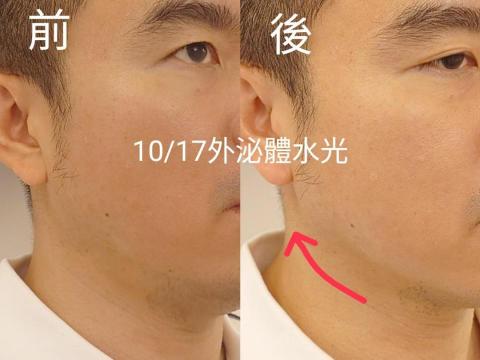 💎鑽泌頭面抗衰水光專家 - 頭面抗衰水光科技美容課程