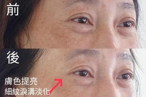 💎鑽泌頭面抗衰水光專家 - 頭面抗衰水光科技美容課程