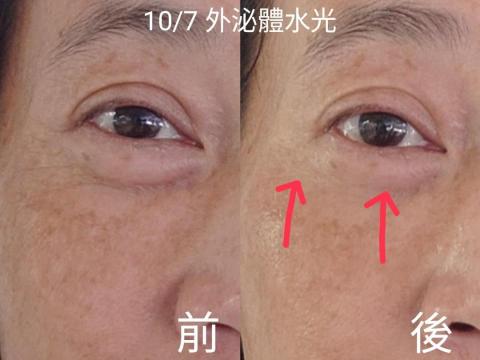 💎鑽泌頭面抗衰水光專家 - 頭面抗衰水光科技美容課程