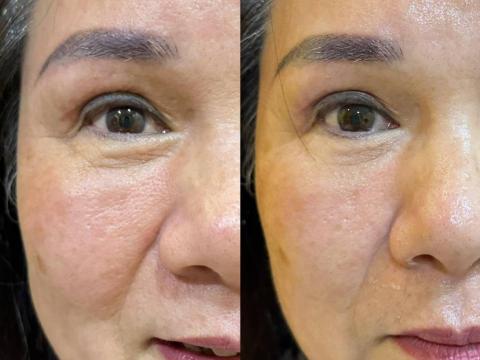 💎鑽泌頭面抗衰水光專家 - 頭面抗衰水光科技美容課程