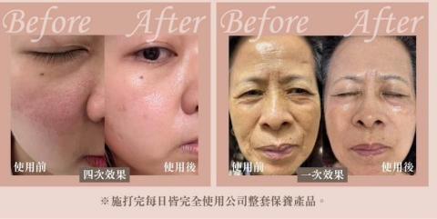 富彩容-造型靓扮美學中心..附設輕 spa 美妍 - 施打5D外秘體效果~歡迎預約