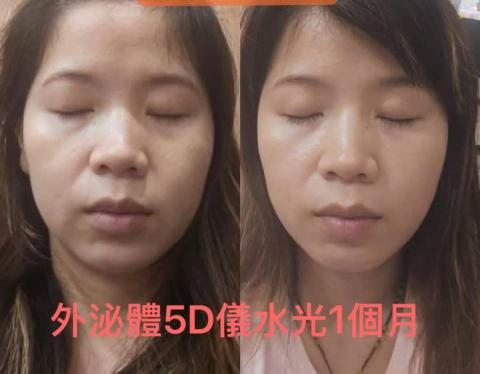 富彩容-造型靓扮美學中心..附設輕 spa 美妍 - 施打5D外秘體效果~歡迎預約