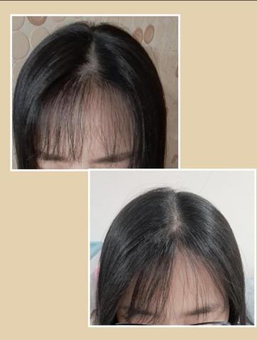 Fanny_pretty_eyelash - 照顧小孩睡眠不足，煩惱壓力大落髮，養護後的改善