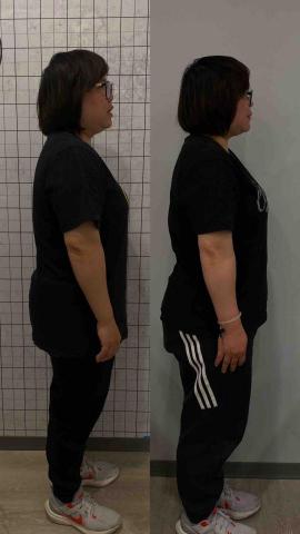 Restes - 筋膜放鬆改善聳肩1個月