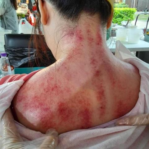 提供刮痧仪服務的專家艾寶寶