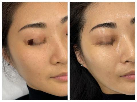 Herman · 赫曼美學-靈芝牛奶外泌體 - 市面上的保養品琳琅滿目，但外泌體並不是一般保養品能比擬的。
它是來自尖端科技的成分，能夠「智慧型」調整肌膚環境，帶來更高階的養膚體驗。
? 與眾不同的原因
	•	精準傳遞：外泌體就像小小信使，能把關鍵養分帶到需要的地方。
	•	高效養膚：不同於傳統塗抹型保養，它能讓肌膚更快感受到調理與呵護。
	•	次世代養護：外泌體代表的是未來趨勢，不只是單純的保濕或滋養，而是全方位的年輕化養護概念。

