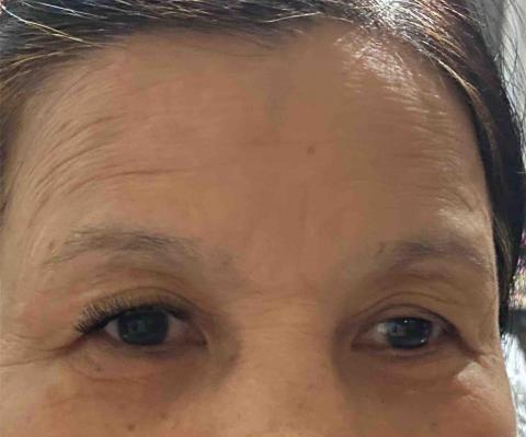 李佩芳 - 嫁接睫毛兩眼對比