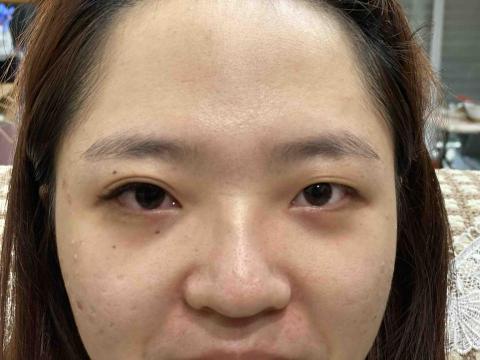 李佩芳 - 嫁接睫毛兩眼對比