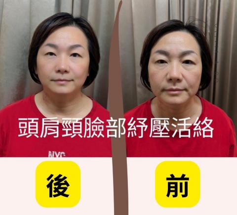 華納經絡美顏工作室 - 頭肩頸臉部舒壓活絡後前後比照