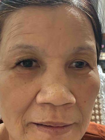 李小姐 - 嫁接睫毛，兩眼差異