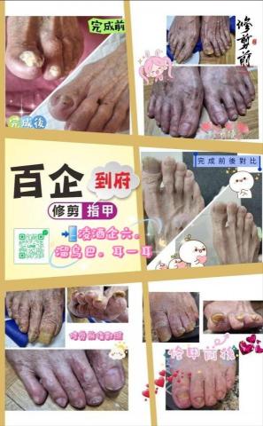 平鎮指甲護理專家推薦百企到府修剪指甲