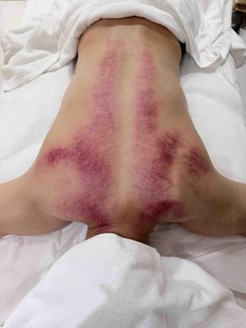 十年經驗到府按摩師 加我賴詳談m********* - 