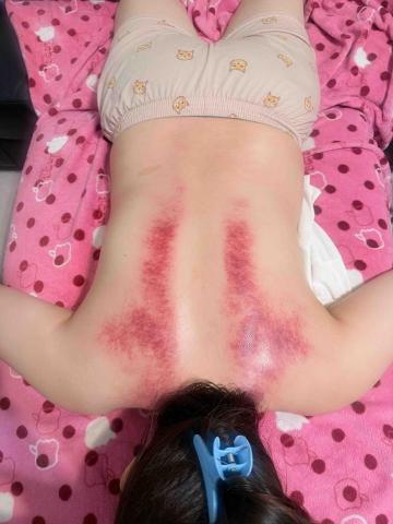 十年經驗到府按摩師 加我賴詳談m********* - 