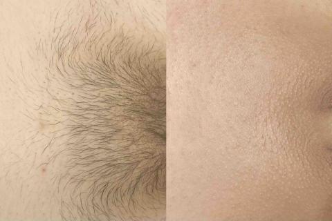 一絲不苟熱蠟美肌工作室 - 熱蠟私密處當下立即無毛亮白光滑