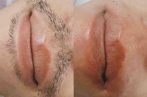 一絲不苟熱蠟美肌工作室 - 熱蠟修護當下對比