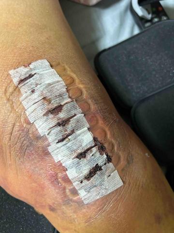 1.1健康家庭護理 - 