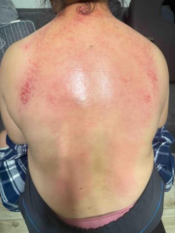 楊老師～15年的美容經驗，平日也是幼稚園的課後班老師，針對個 - 體驗溫罐