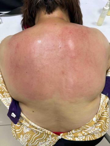 楊老師～15年的美容經驗，平日也是幼稚園的課後班老師，針對個 - 客戶身體長期僵硬，牛角按摩讓身體放鬆