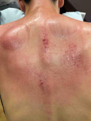 楊老師～15年的美容經驗，平日也是幼稚園的課後班老師，針對個 - 