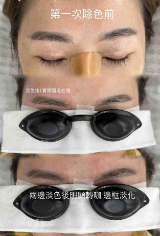 Onls tudio雍倪美學 - 眉毛淡色：依想要效果  次數遞增！