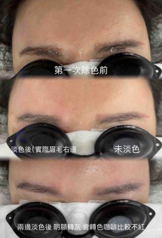 Onls tudio雍倪美學 - 紅眉轉色案例 代謝觀察2週為最終效果