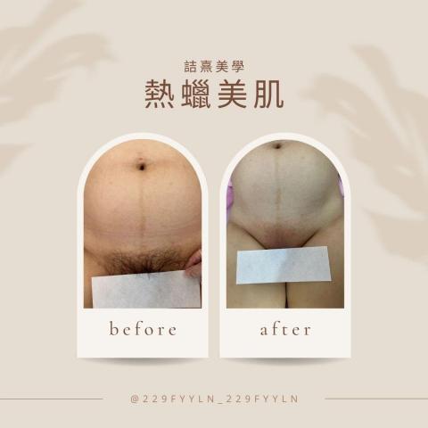 詰熹美學 - 孕婦私密處