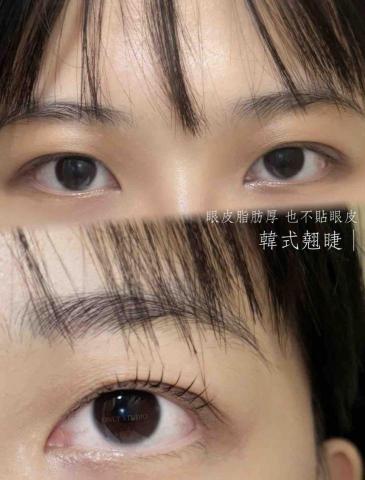 Onls tudio雍倪美學 - 脂肪厚也可以美美