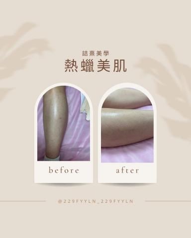 詰熹美學 - 小腿