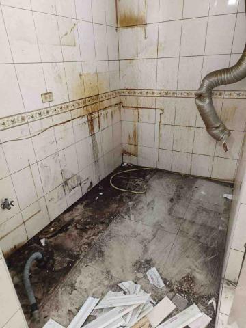 胡恩瑋 - 整形外科手術前