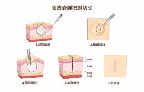 王思驊 - 醫療插圖