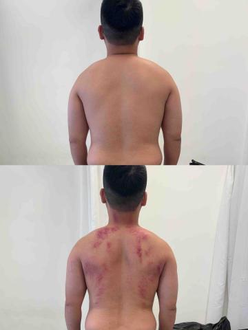 葉宗烜 - 放鬆前後對比