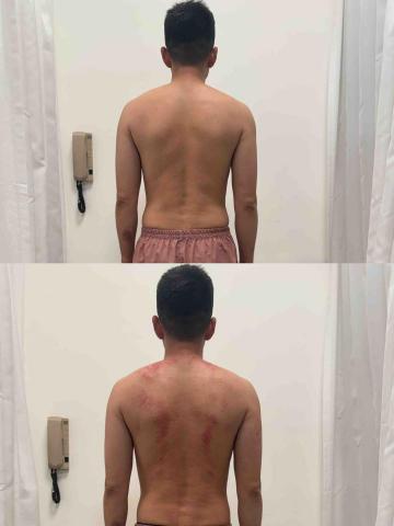 葉宗烜 - 放鬆前後對比