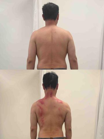 葉宗烜 - 放鬆前後對比