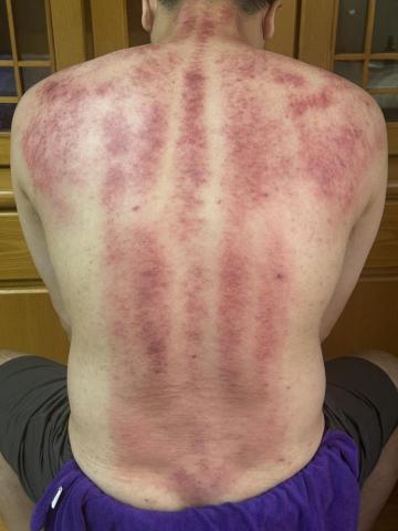 瓦西刮痧按摩工作室 - 刮背